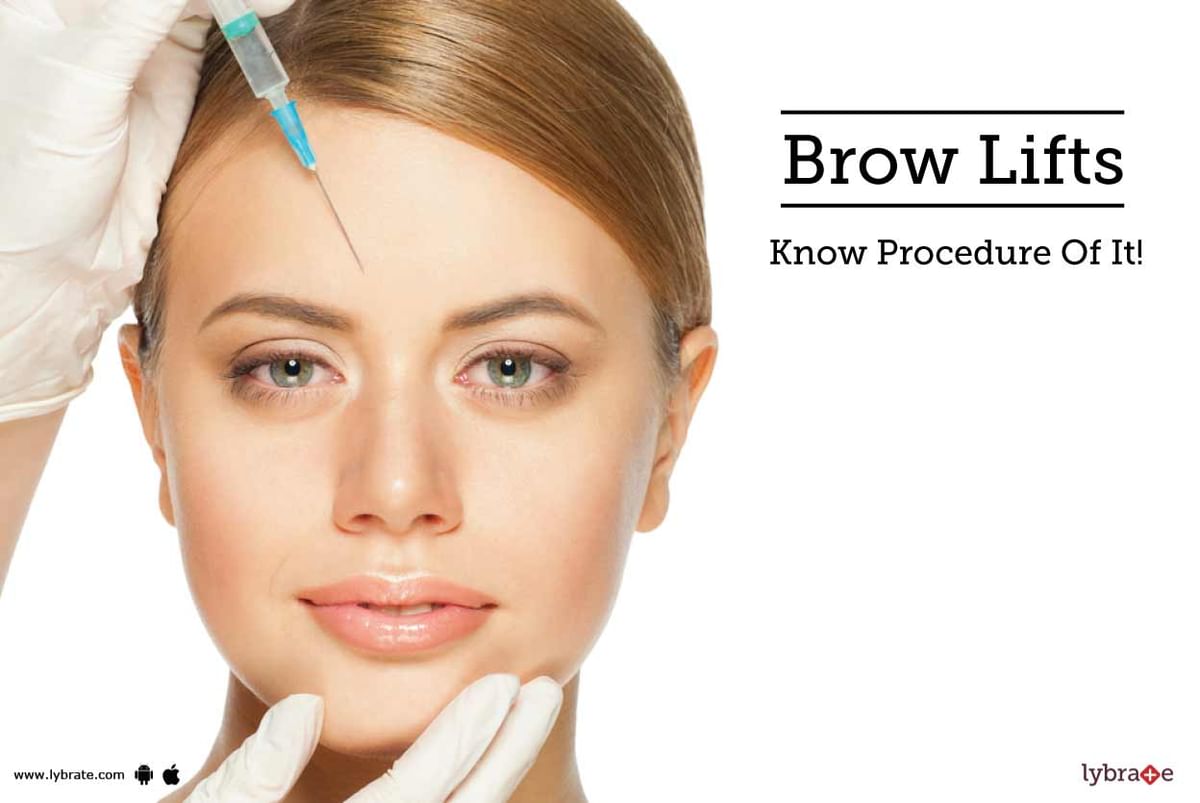 Brow Lift - Know Procedure Of It! - By Dr. Geetika Paliwal | Lybrate