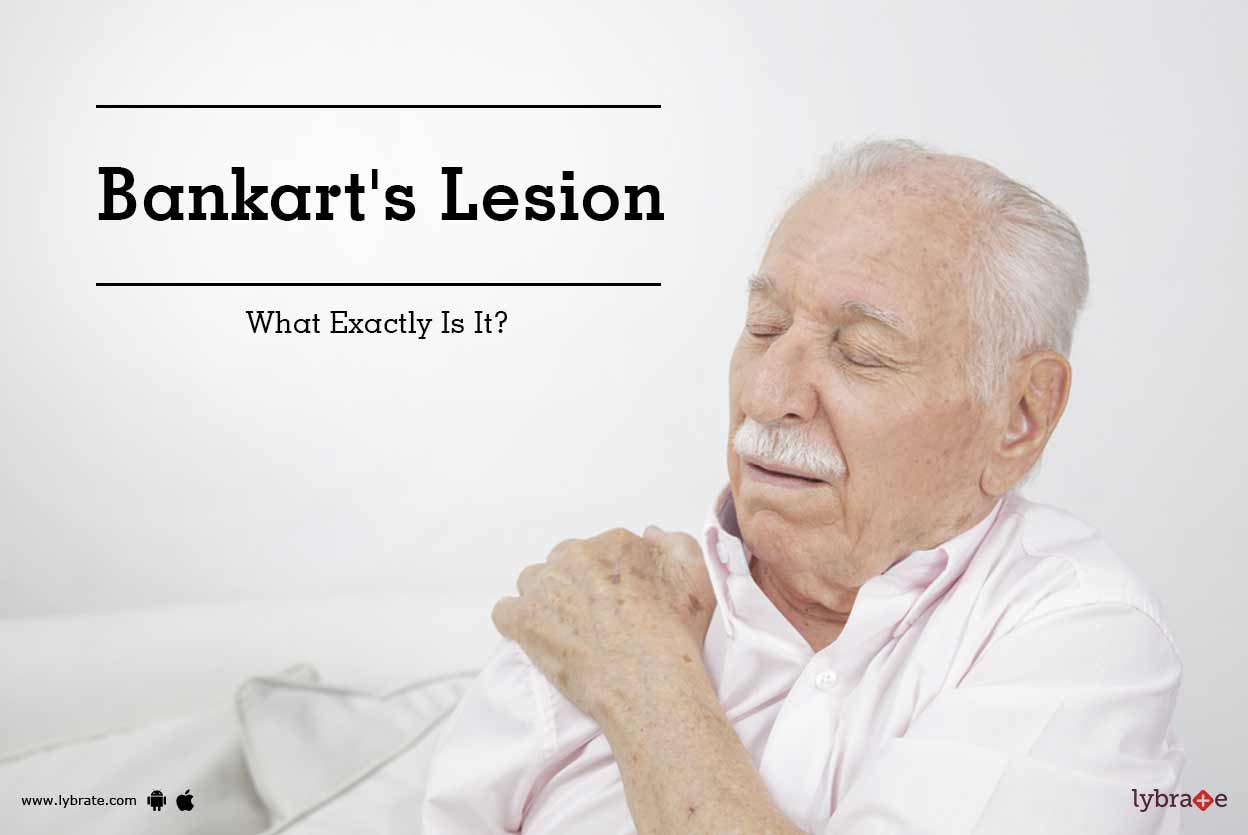 Bankart's Lesion What Exactly Is It? By Dr. Rakesh Kumar Lybrate