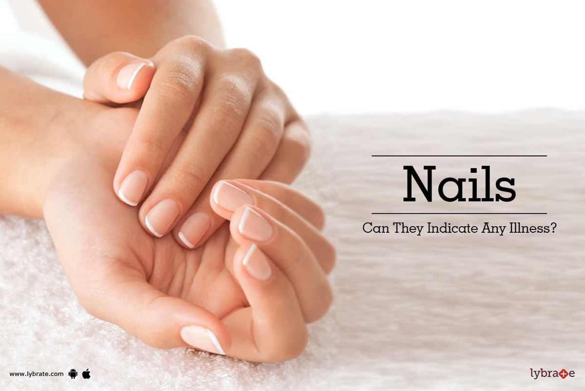 Nails - Can They Indicate Any Illness? - By Dr. Professor Bhavesh Acharya |  Lybrate