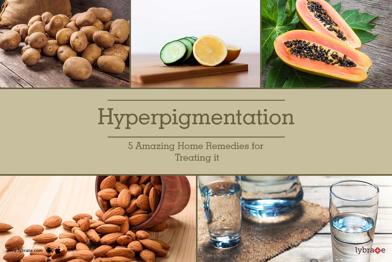 Hyperpigmentation 5 Amazing Home Remedies for Treating it By Dr