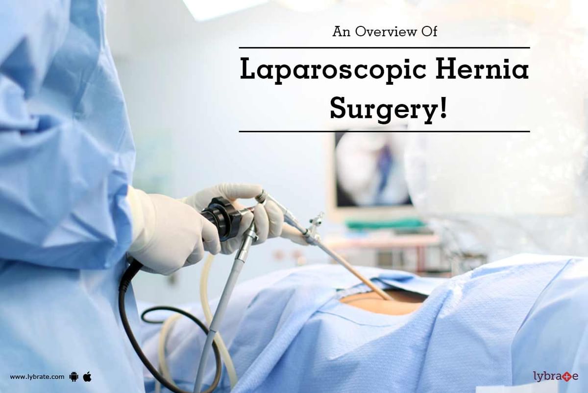 An Overview Of Laparoscopic Hernia Surgery! - By Dr. Adarsh M Patil ...