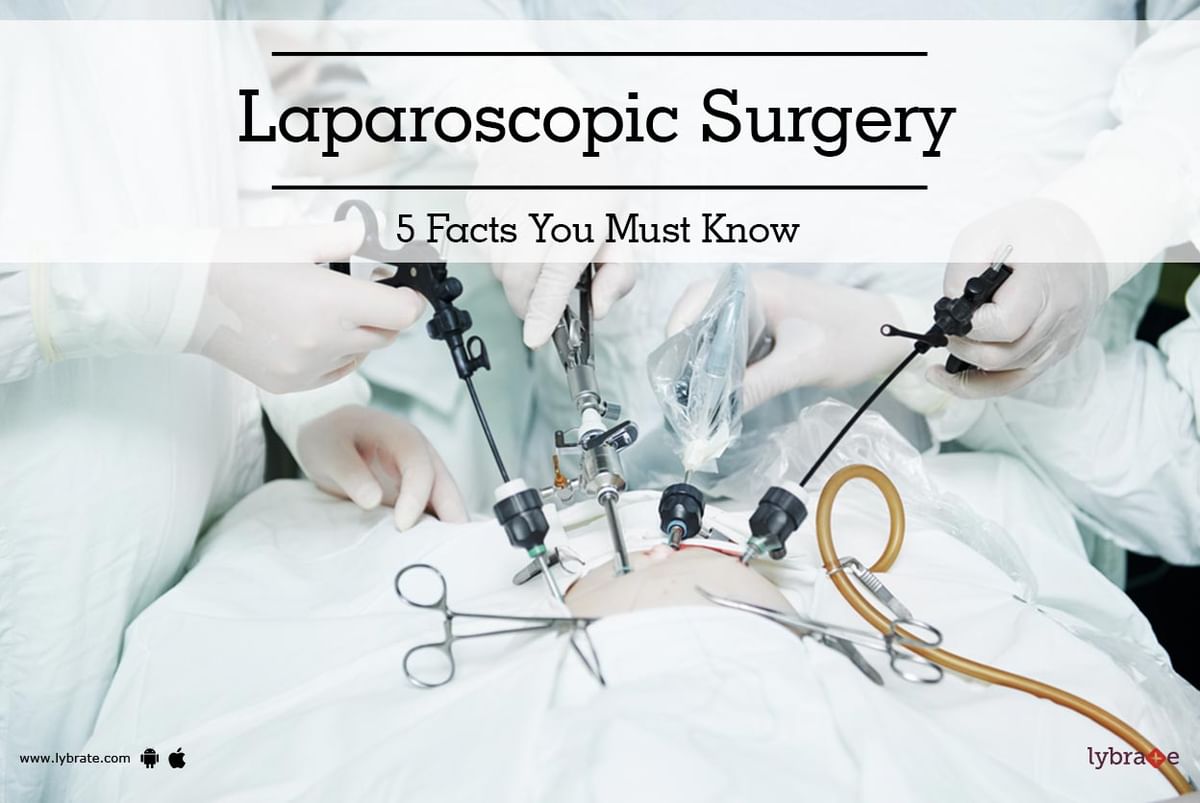 Laparoscopic Surgery: 5 Facts You Must Know - By Dr. Nimesh Shah | Lybrate