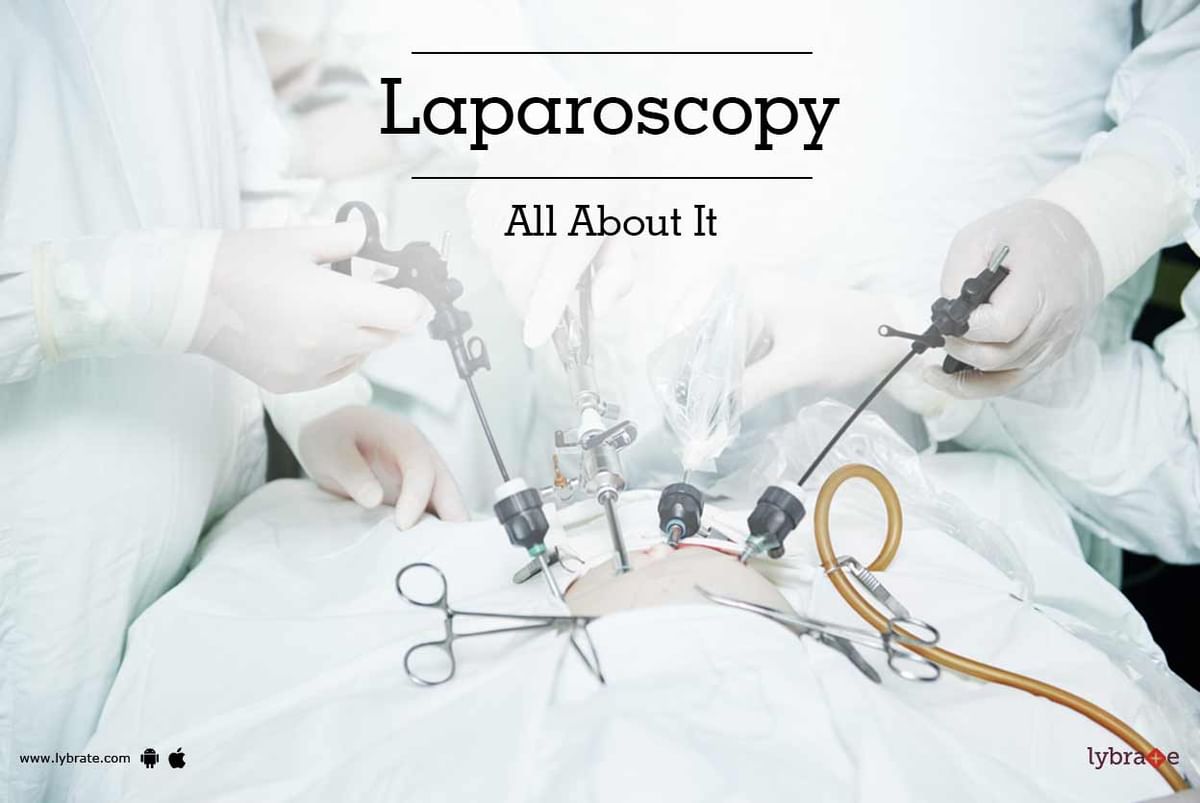 Laparoscopy: All About It - By Dr. Ashit Sharma | Lybrate