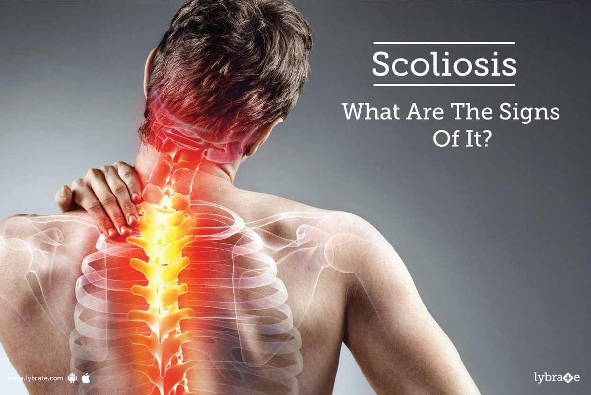 Scoliosis - What Are The Signs Of It? - By Dr. Baljit Singh | Lybrate