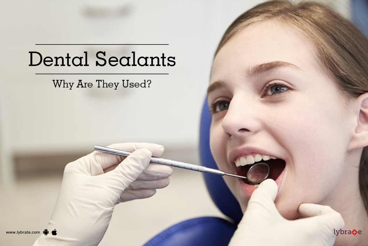 Dental Sealants - Why Are They Used? - By Dr. Premendra Goyal | Lybrate