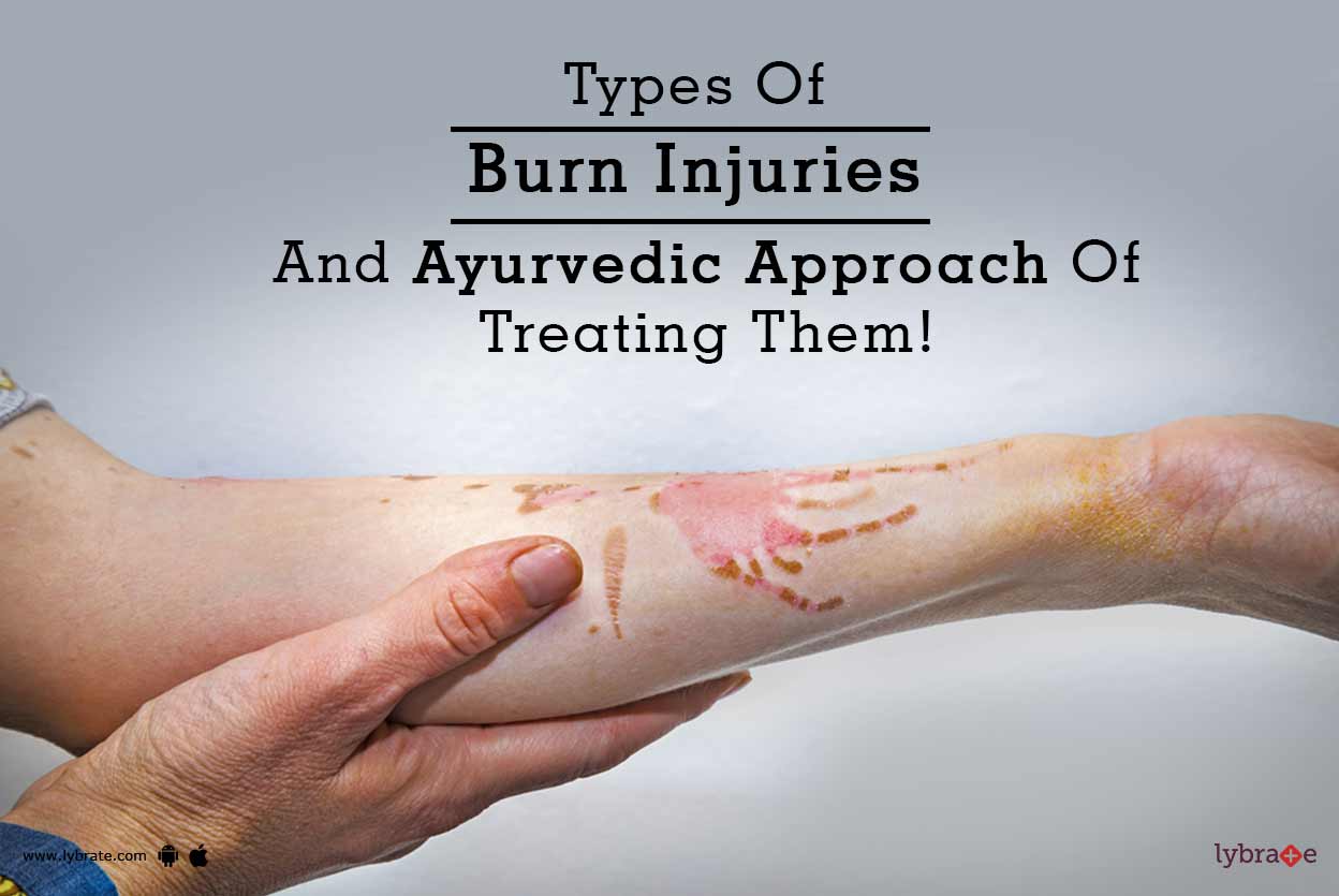 Types Of Burn Injuries And Ayurvedic Approach Of Treating Them! By Dr