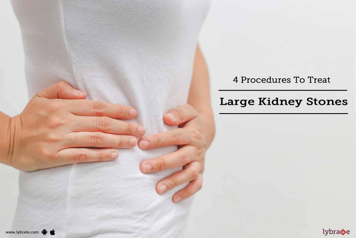 4 Procedures To Treat Large Kidney Stones By Dr. Sarwar Eqbal Lybrate