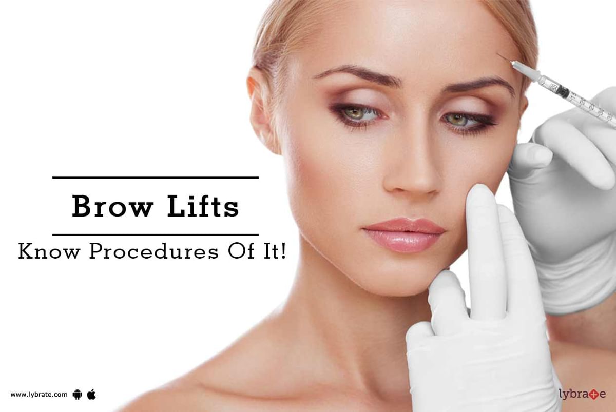 Brow Lifts - Know Procedures Of It! - By Dr. Manoj Bachhav | Lybrate