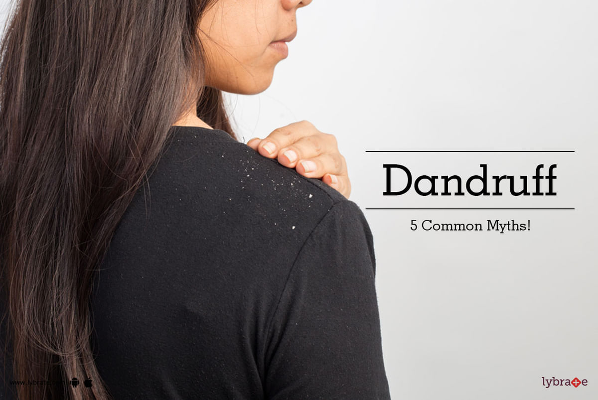 Dandruff Common Myths By Dr Shivali Sethi Lybrate