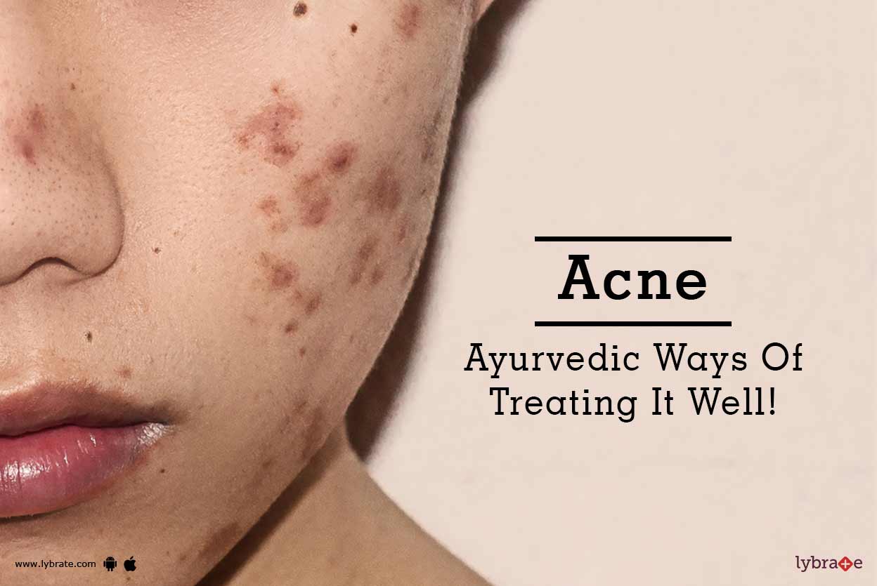 Acne Ayurvedic Ways Of Treating It Well! By Dr. Sunil Arya Lybrate
