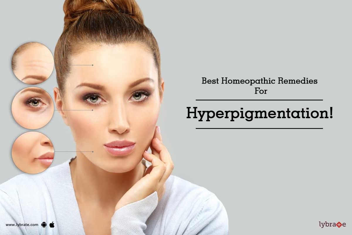 Best Homeopathic Remedies For Hyperpigmentation! - By Dr. Mukesh Singh |  Lybrate