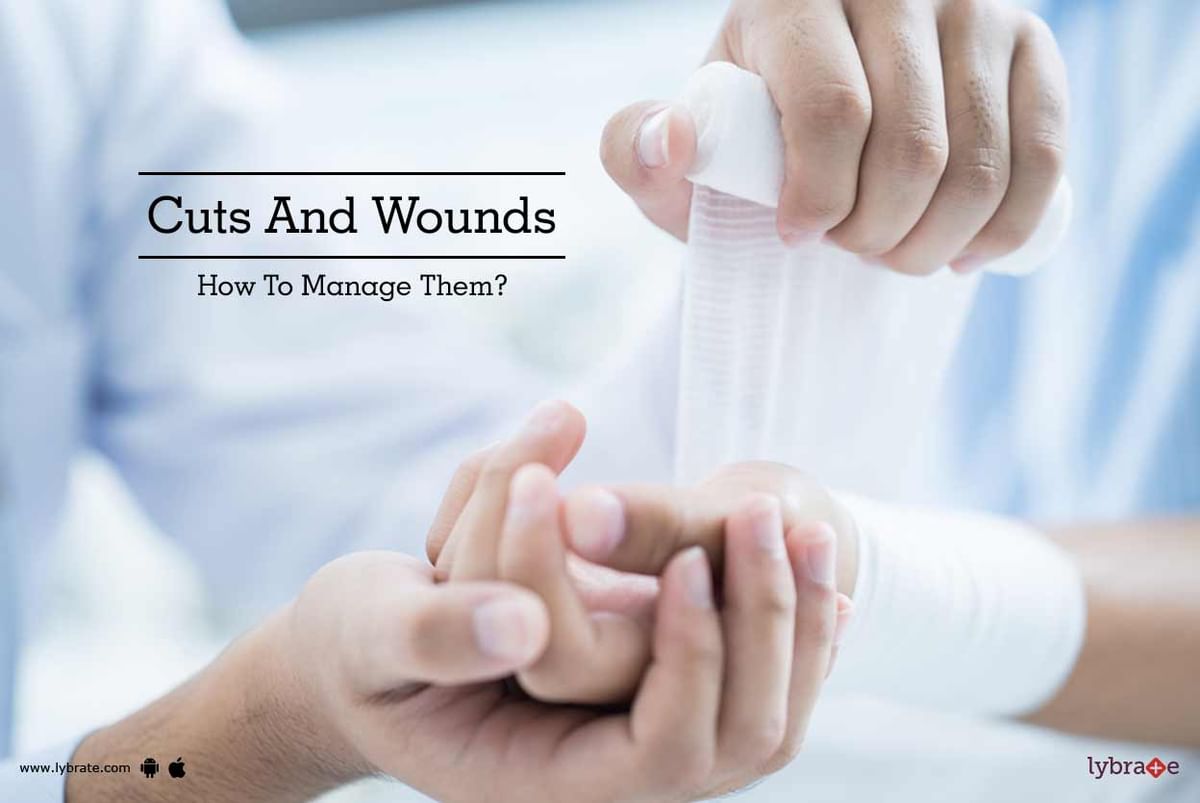 Cuts And Wounds - How To Manage Them? - By Dr. Nash Kamdin | Lybrate