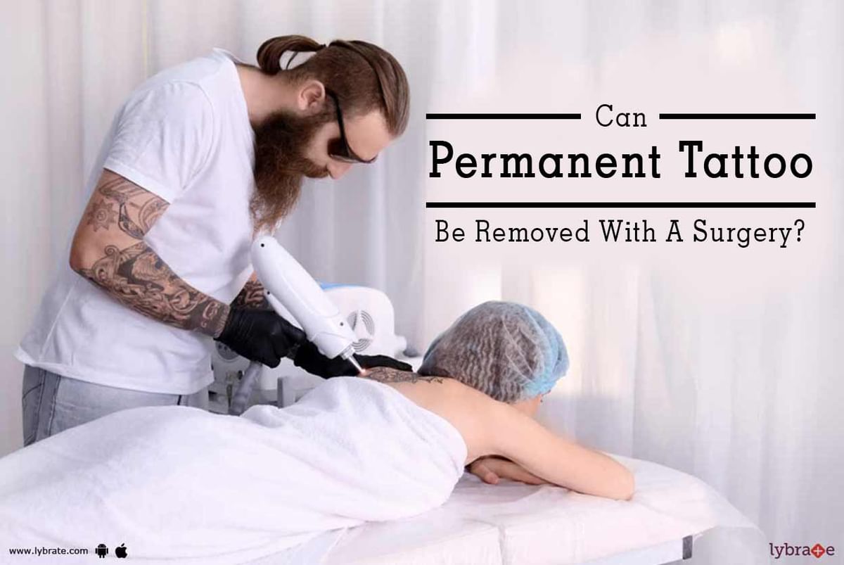 How To Remove A Permanent Tattoo DIY Methods and Surgical Methods