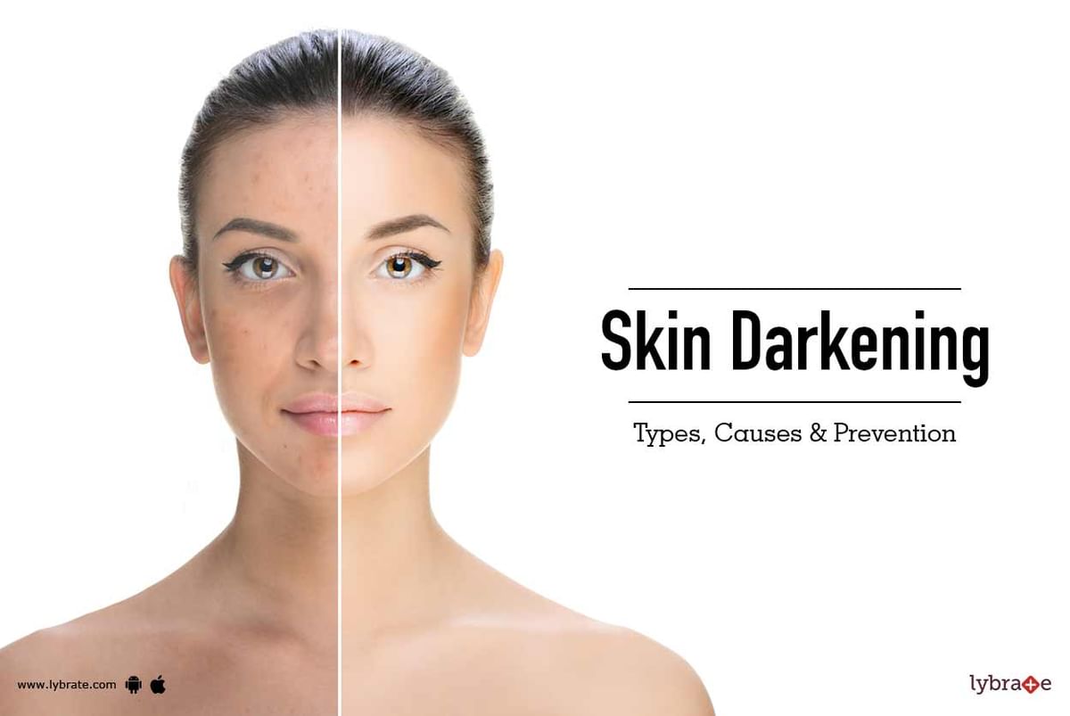 reasons-why-your-facial-skin-is-darker-than-your-body-with-45-off