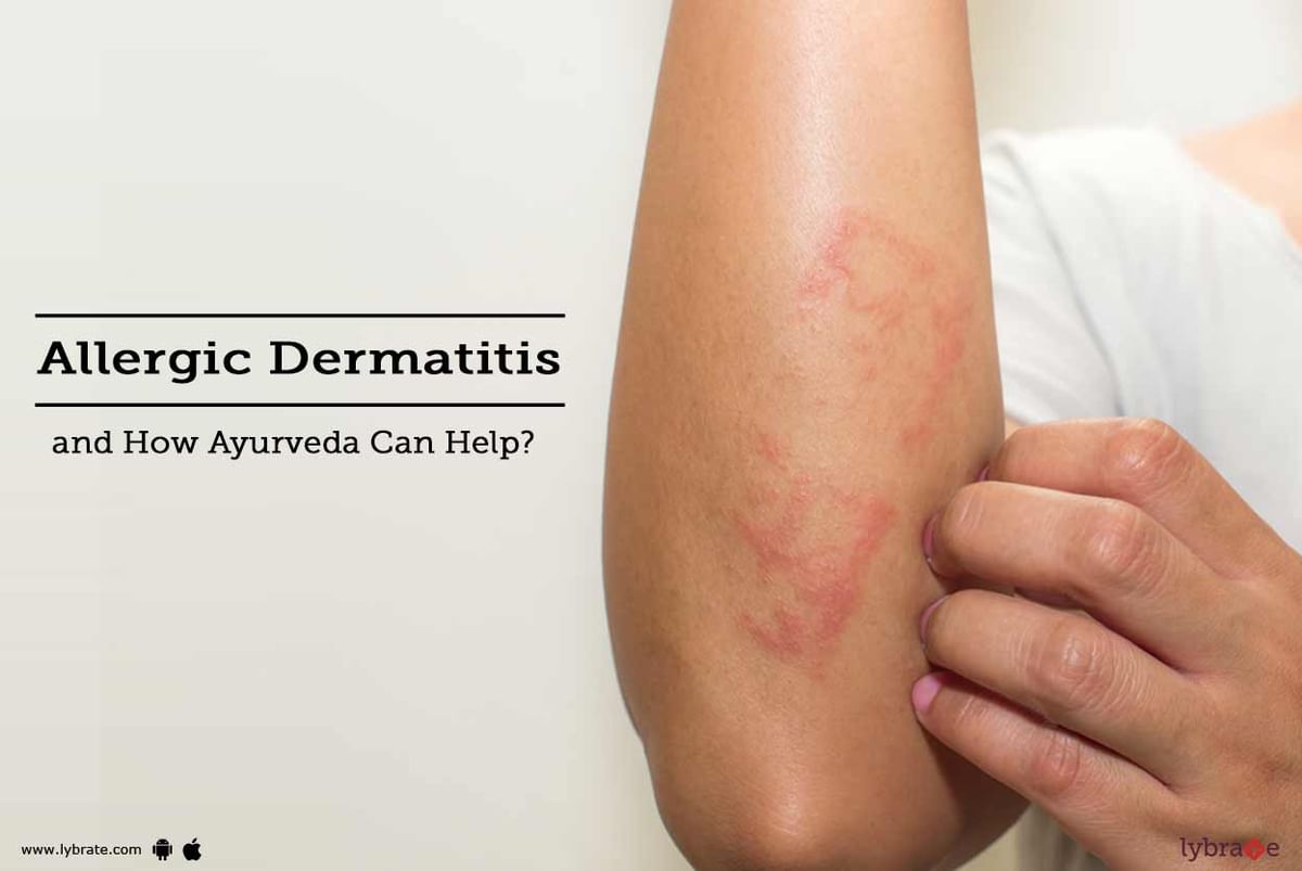 How Ayurveda Can Help in Allergic Dermatitis Treatment - By Dr. Manoj  Virmani | Lybrate