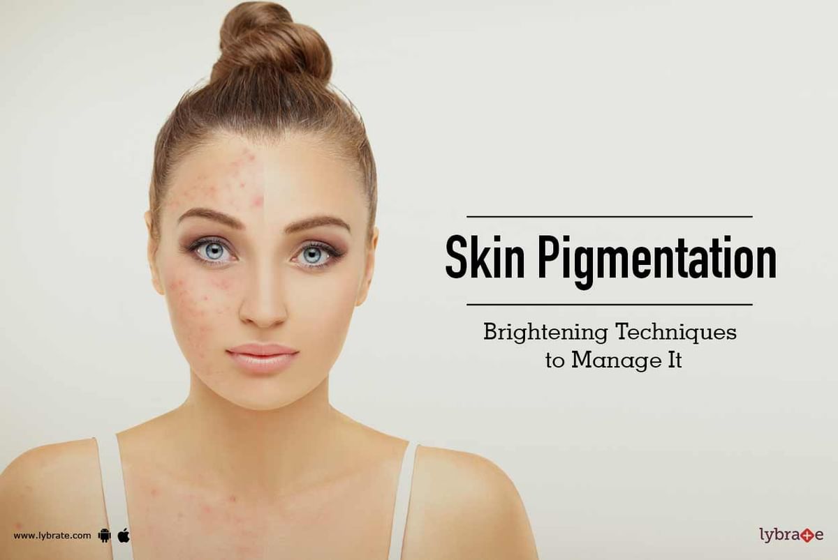 Skin Pigmentation - Brightening Techniques to Manage It - By Kaya Skin ...