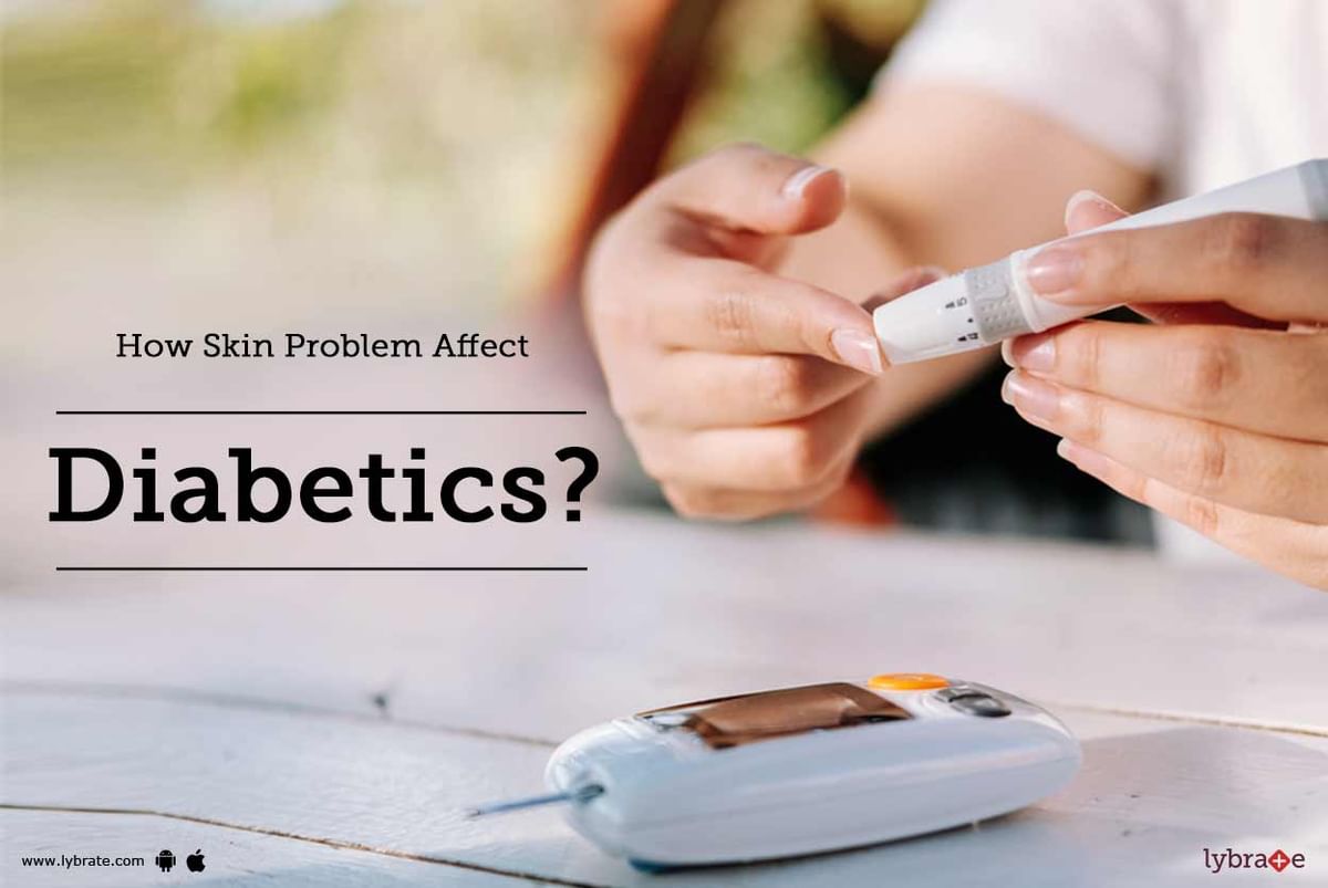 How Skin Problem Affect Diabetics? - By Dr. Dhananjay Chavan | Lybrate