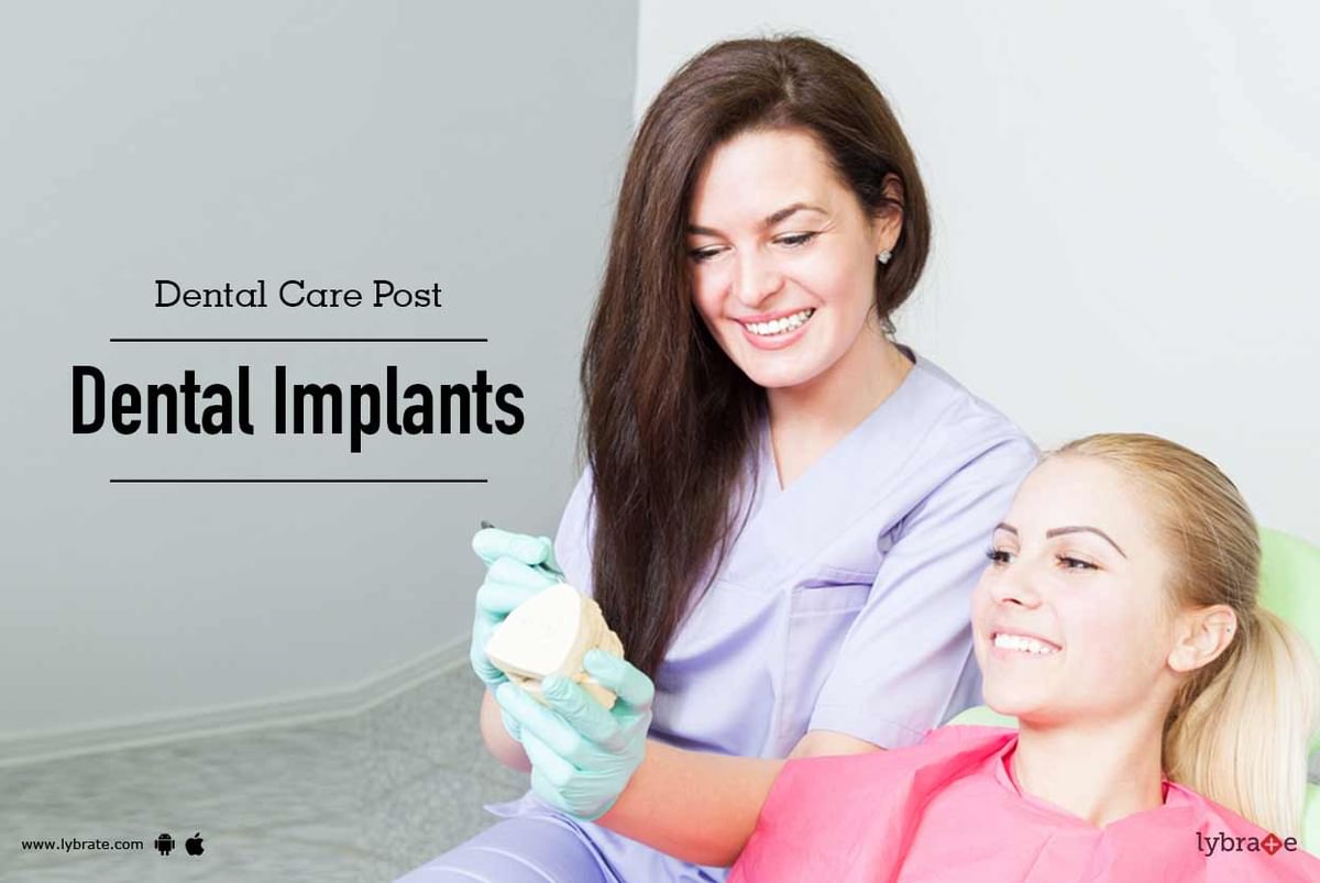 Dental Care Post Dental Implants - By Dr. Supreeth S. M | Lybrate