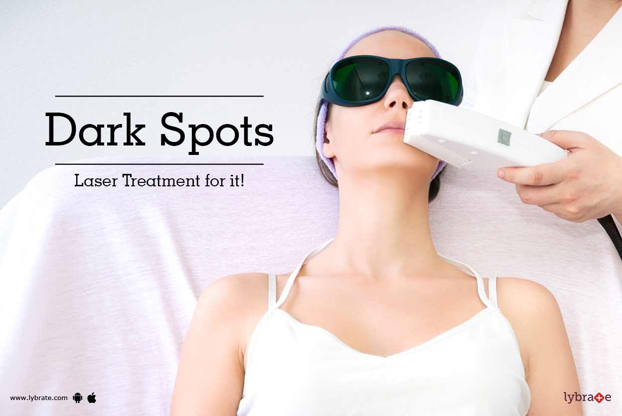 Dark Spots Laser Treatment for it! By Dr. Arvind Kumar Lybrate