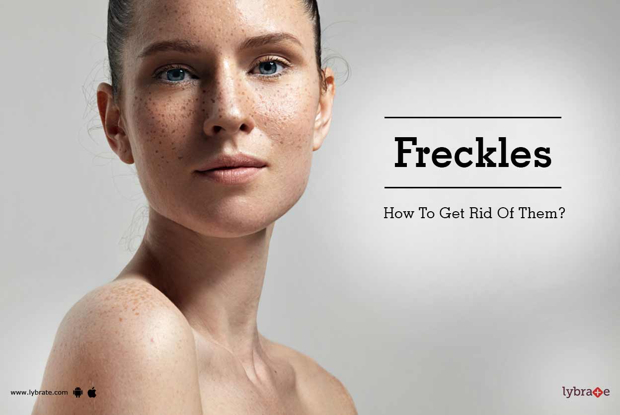 Freckles How To Get Rid Of Them? By Dr. Sharat Gupta Lybrate