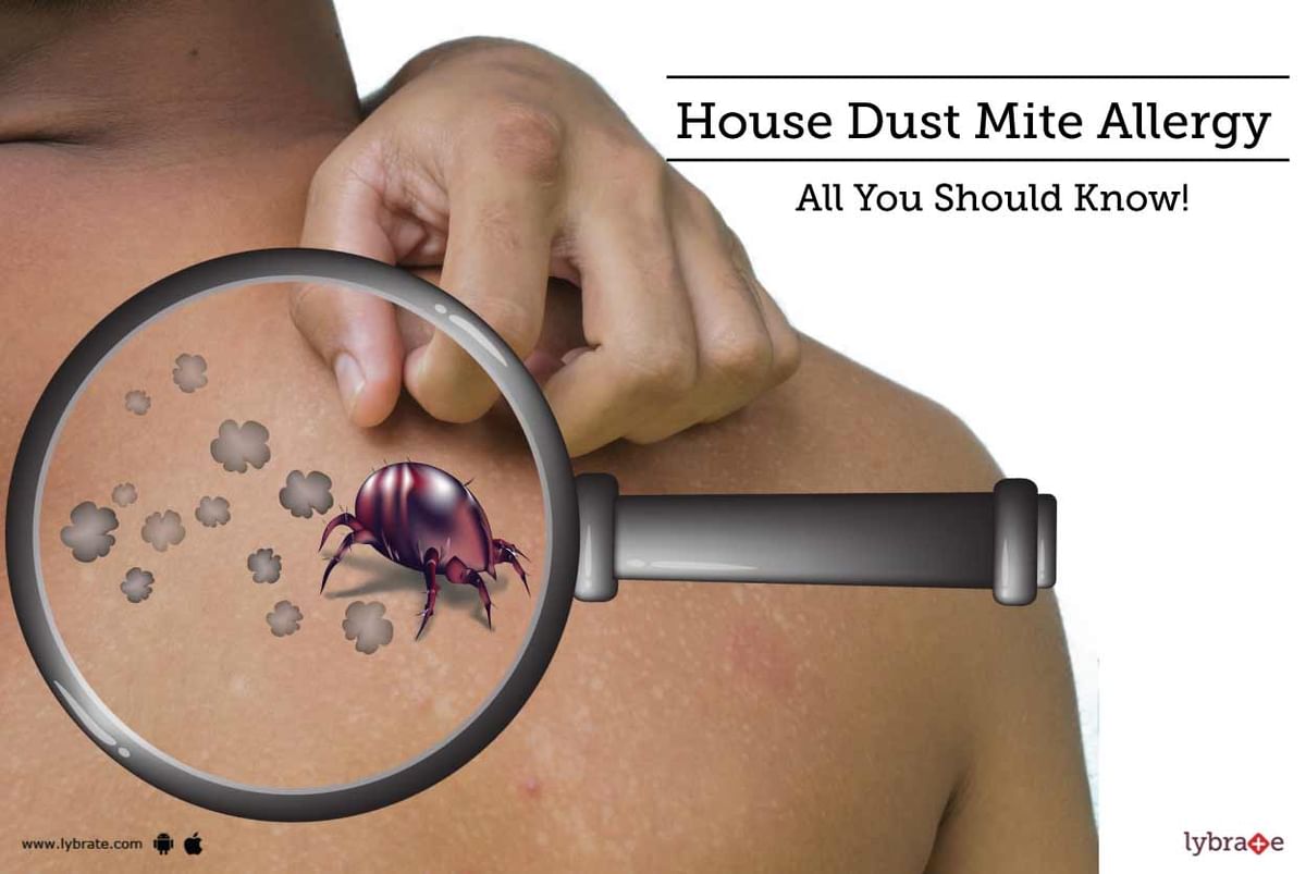 House Dust Mite Allergy - All You Should Know! - By Dr. Roopali Jain  Tripathi | Lybrate