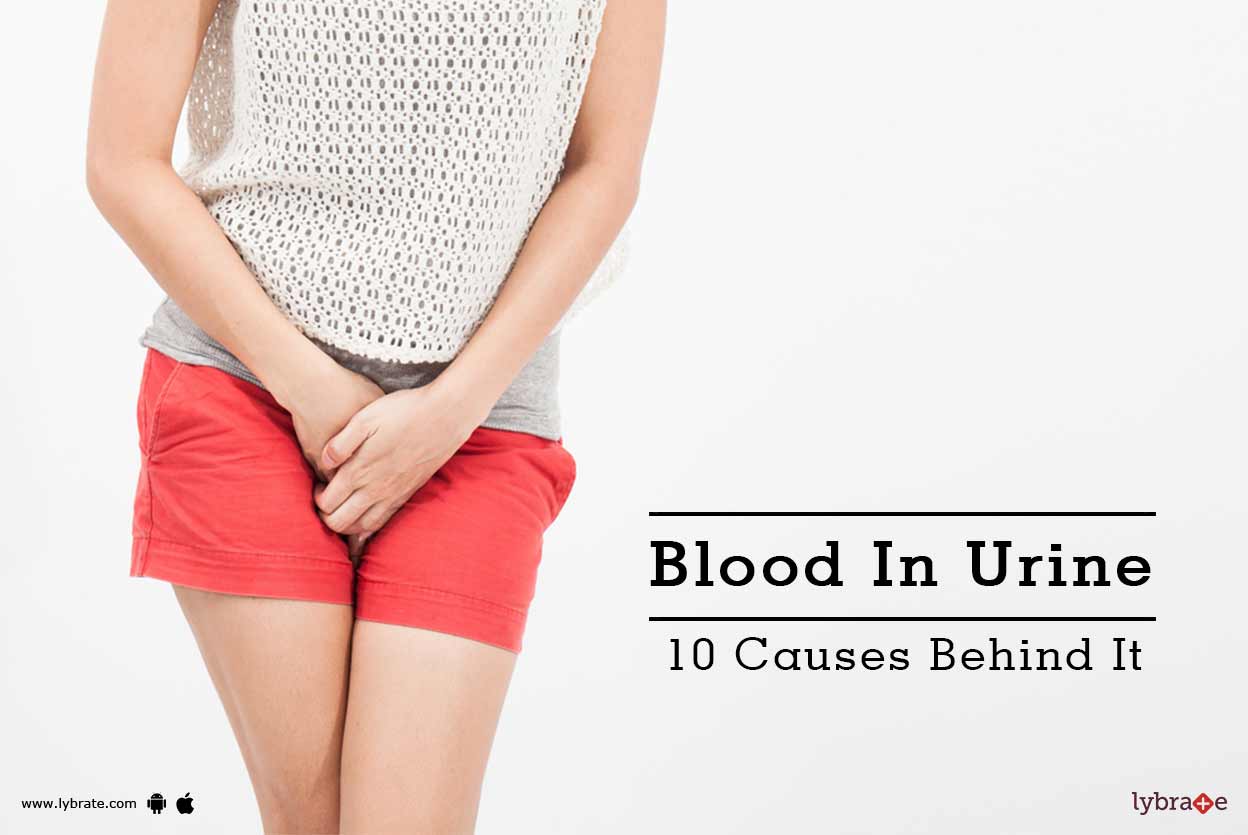 Blood In Urine 10 Causes Behind It By Dr. Pawan Mittal Lybrate