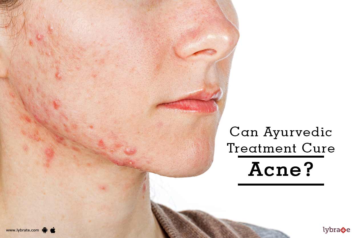 Can Ayurvedic Treatment Cure Acne? By Dr. Shamkant Chaudhari Lybrate