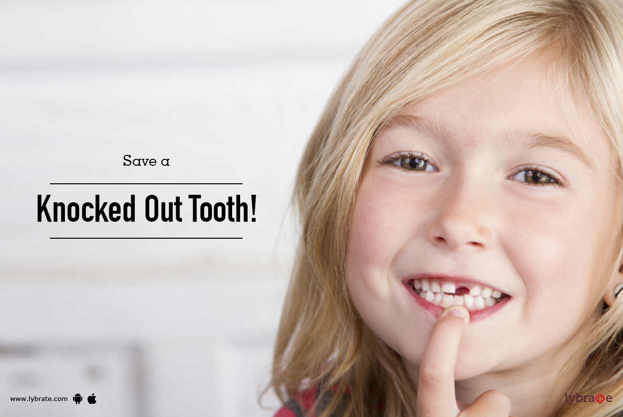 Save a Knocked Out Tooth! By Dr. Vineet Kapoor Lybrate