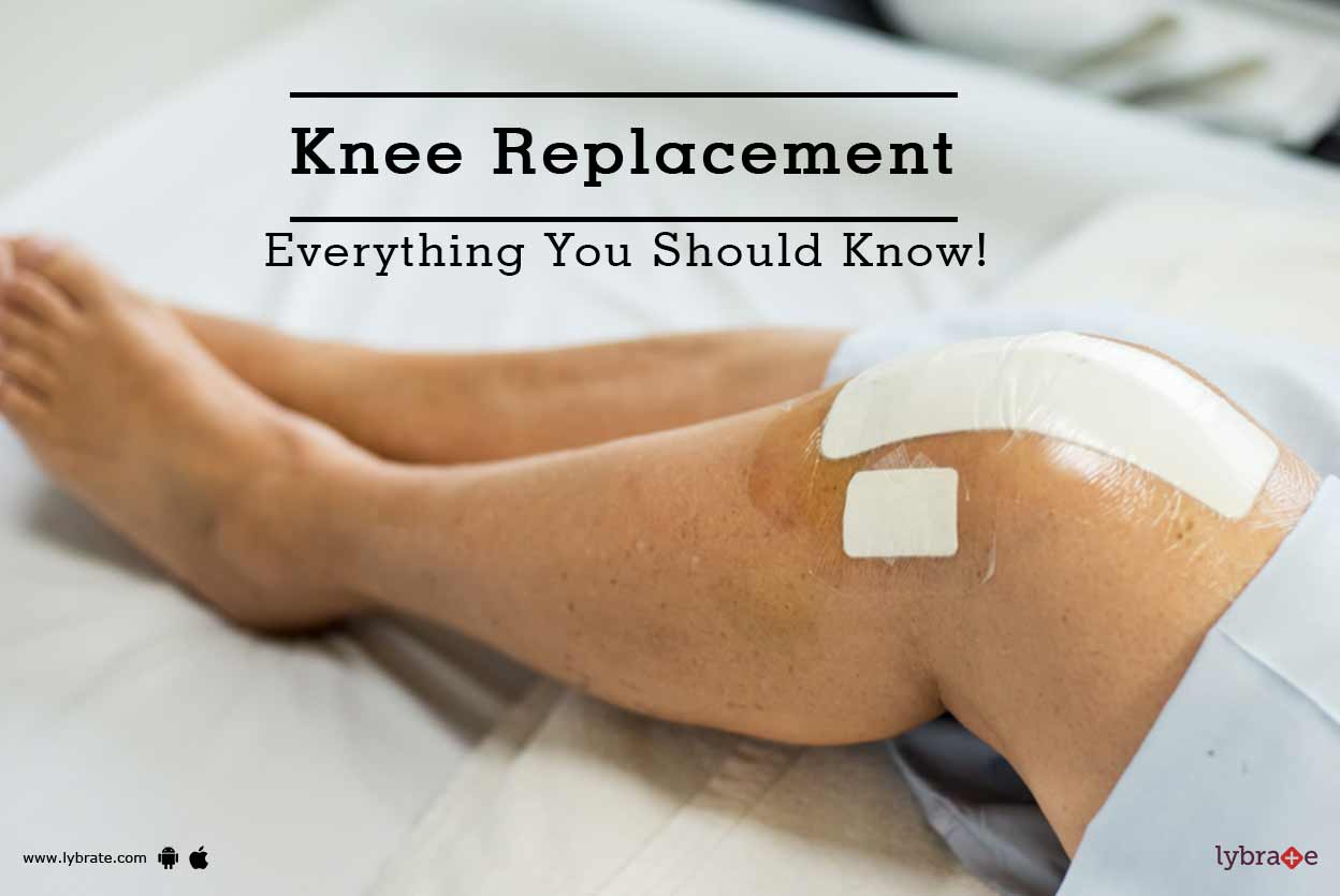 Knee Replacement Everything You Should Know! By Dr. Ankur Singhal
