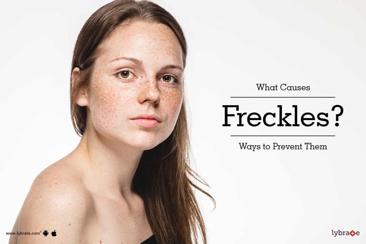 What Causes Freckles? Ways to Prevent Them - By Dr. Himanshu Singhal ...