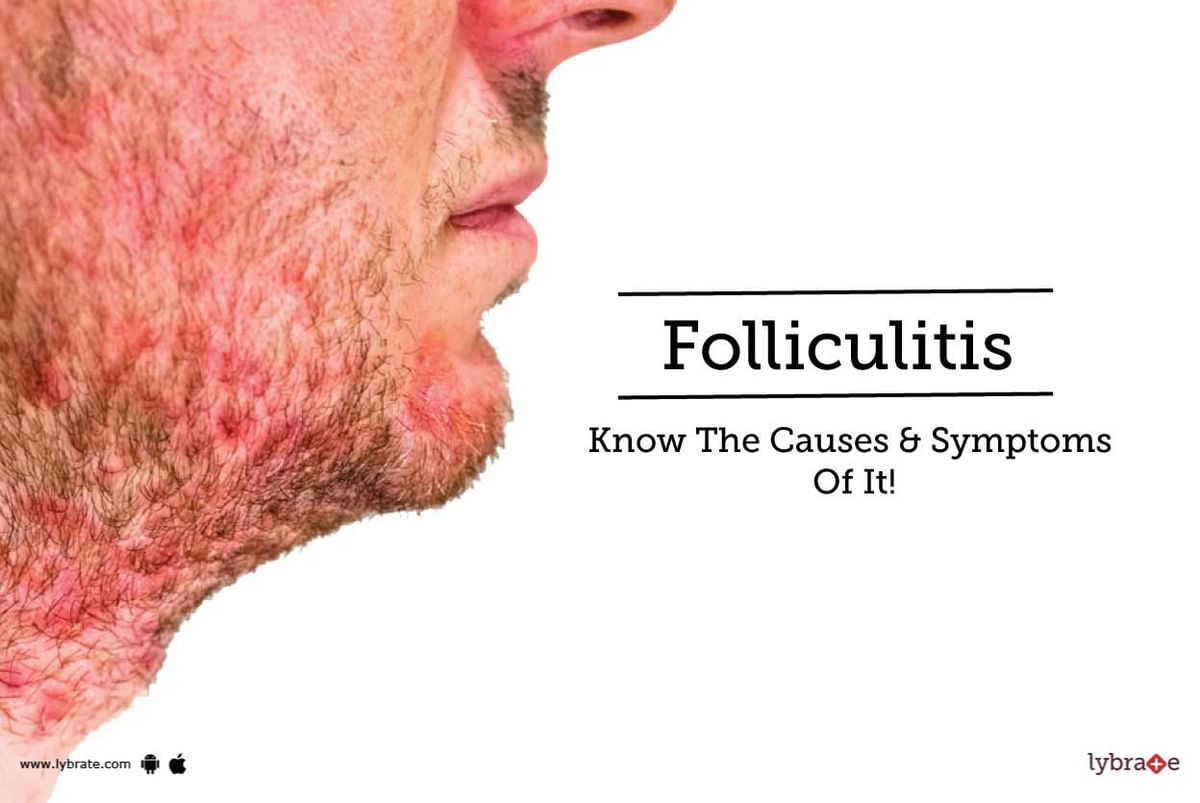 Folliculitis Know The Causes And Symptoms Of It By Dr Niraj Jain Lybrate 