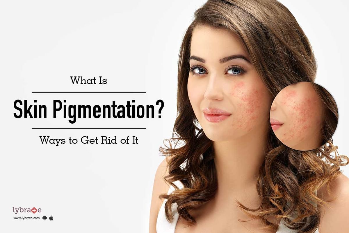 What Is Skin Pigmentation? Ways To Get Rid Of It - By Dr. Nimesh D 