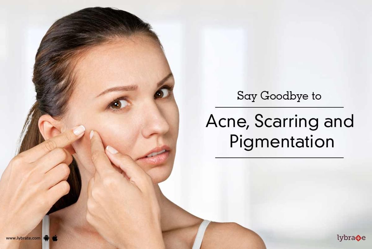 Say Goodbye to Acne, Scarring and Pigmentation - By Dr. Ashish M ...