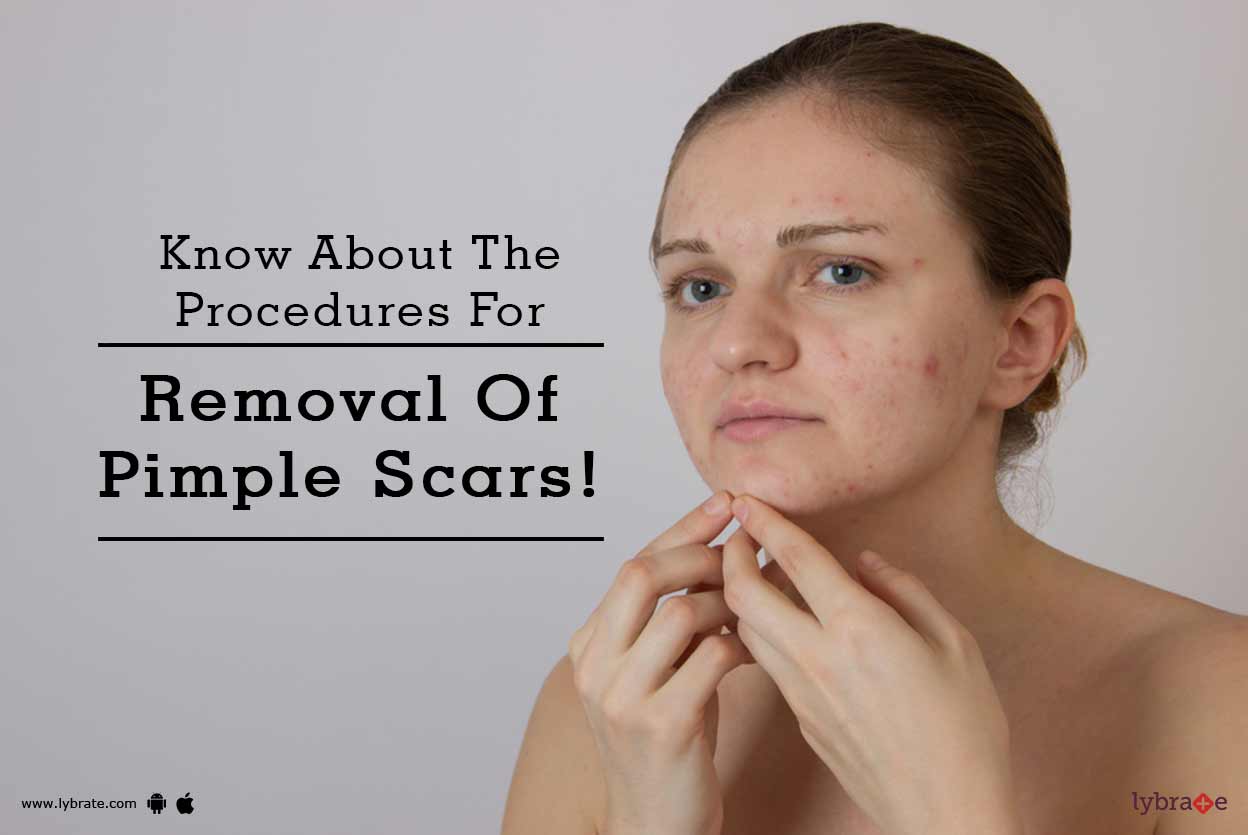 Know About The Procedures For Removal Of Pimple Scars! By Dr. Ajaya
