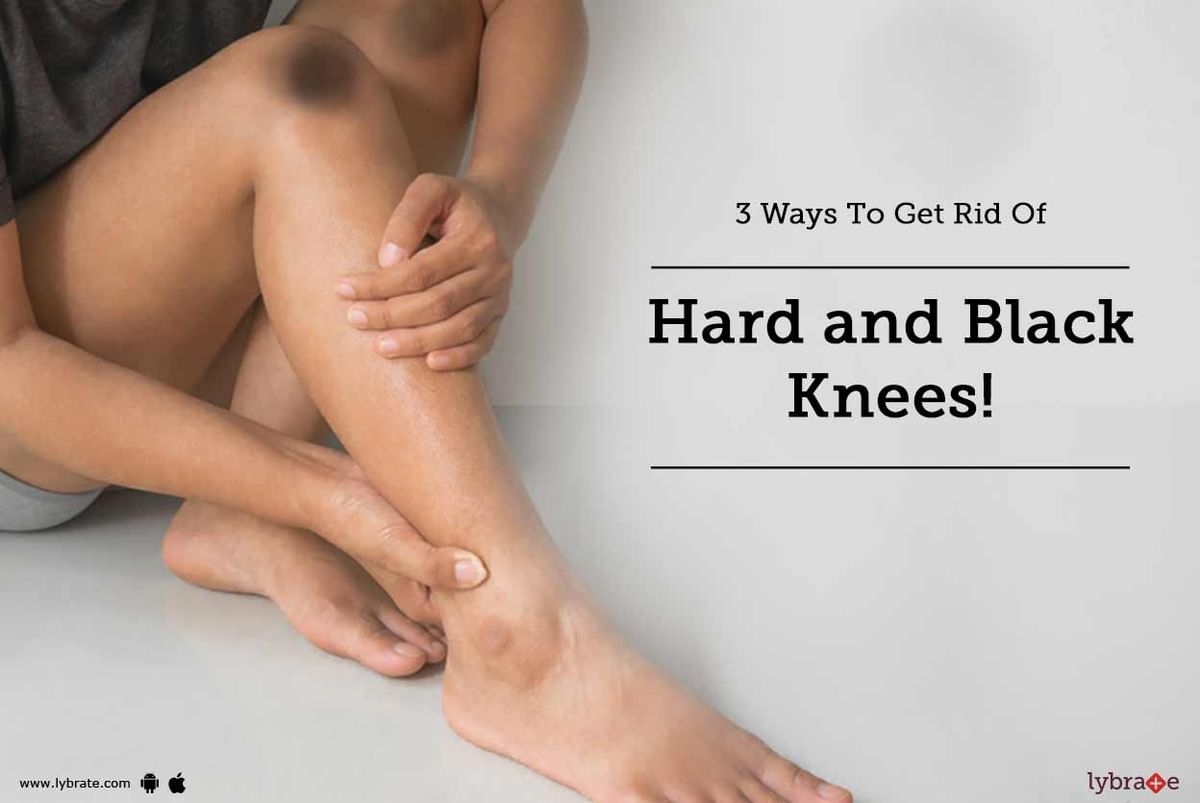 3 Ways To Get Rid Of Hard and Black Knees! - By Dr. Dhananjay Chavan | Lybrate
