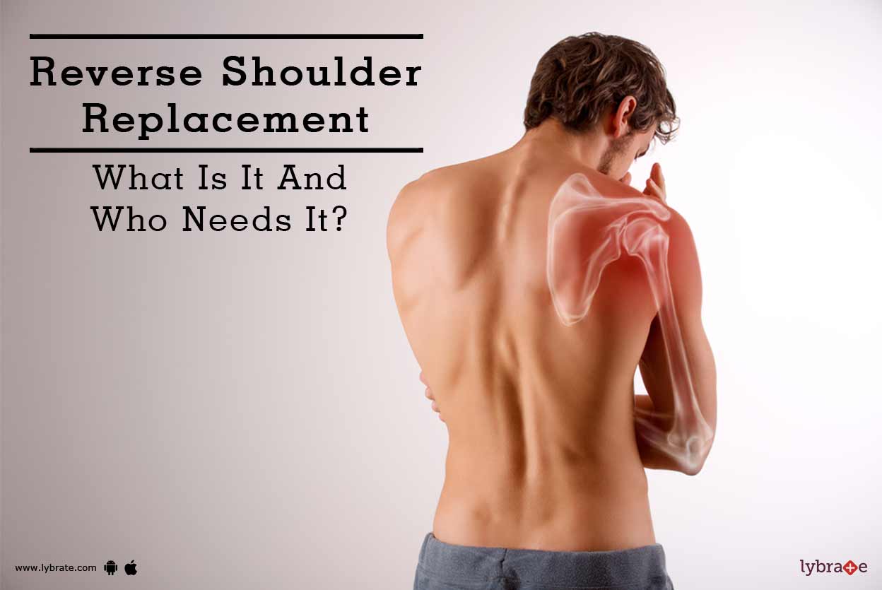Reverse Shoulder Replacement What Is It And Who Needs It? By Dr