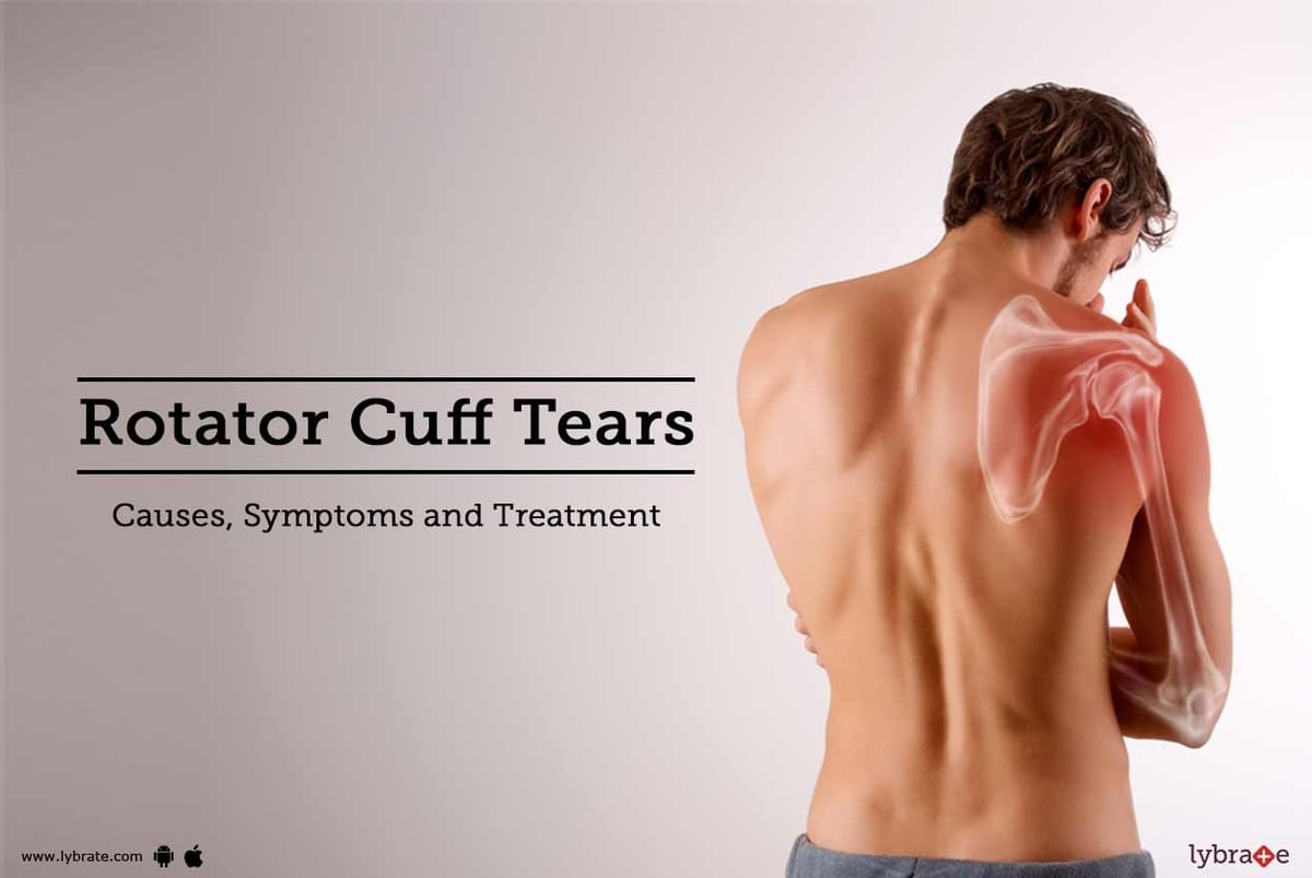 Rotator Cuff Tear: Symptoms & Treatment