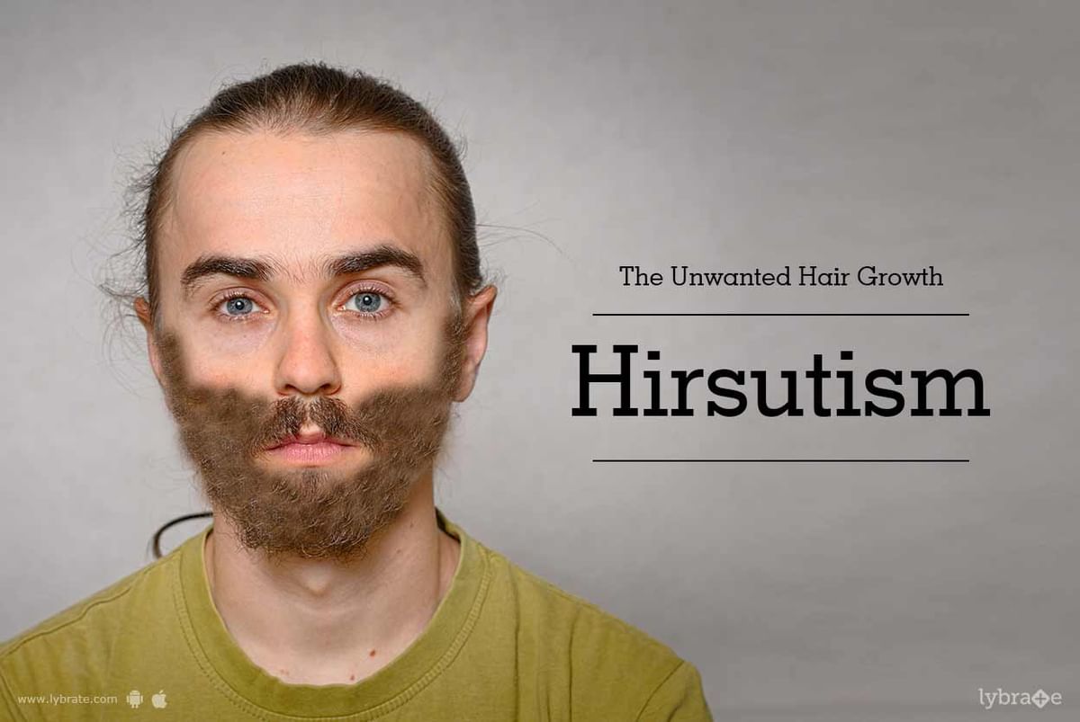 The Unwanted Hair Growth- Hirsutism - By Paras Hospitals | Lybrate