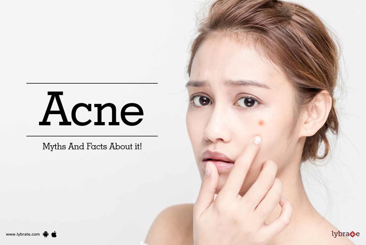 Acne Myths And Facts About It By Dr Jyoti Chourasia Lybrate 5014