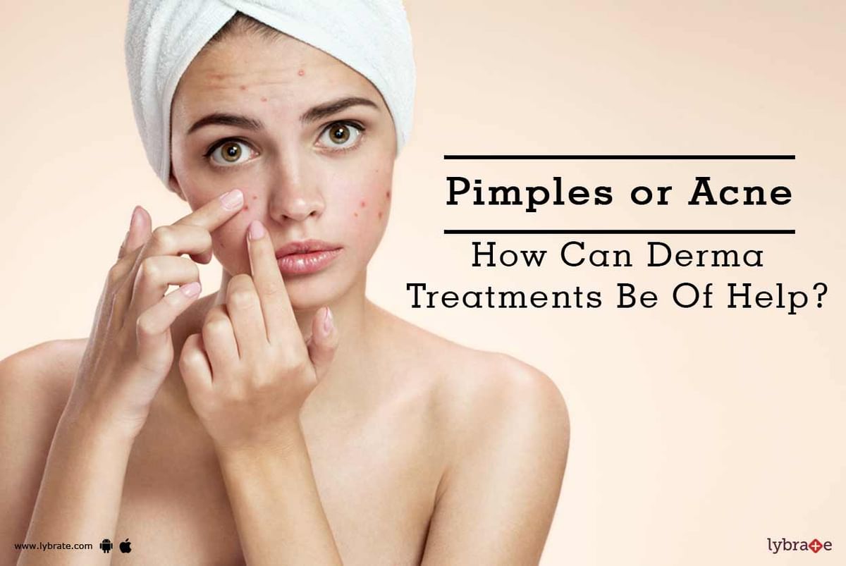 Pimples or Acne - How Can Derma Treatments Be Of Help? - By Dr. Sandeep ...