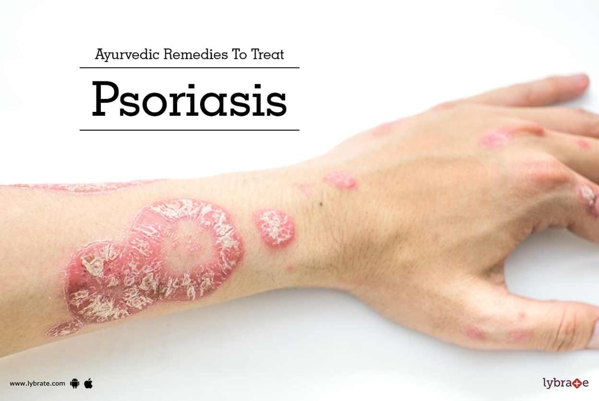 Ayurvedic Remedies To Treat Psoriasis - By Dr. Nischay Bidada | Lybrate