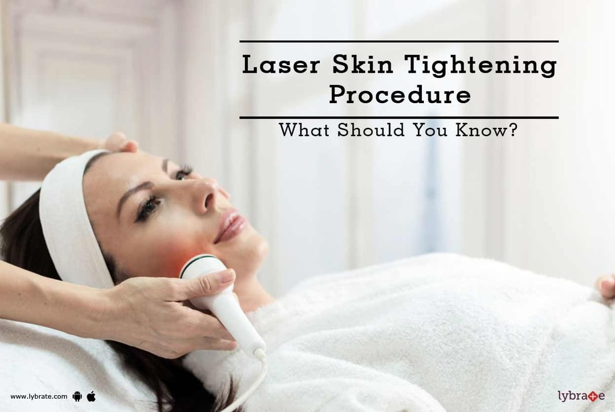 Laser Skin Tightening Procedure - What Should You Know? - By The ...