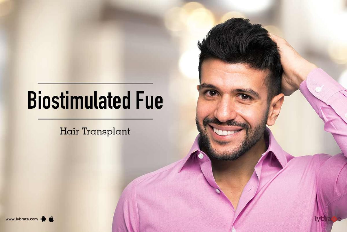 Biostimulated FUE Hair Transplant - By Dr. Ashit Gupta | Lybrate