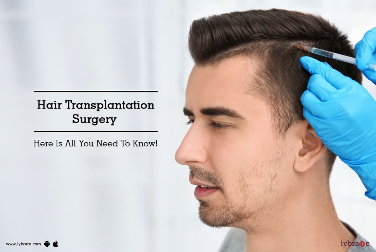 Hair Transplantation Surgery - Here Is All You Need To Know! - By Dr ...