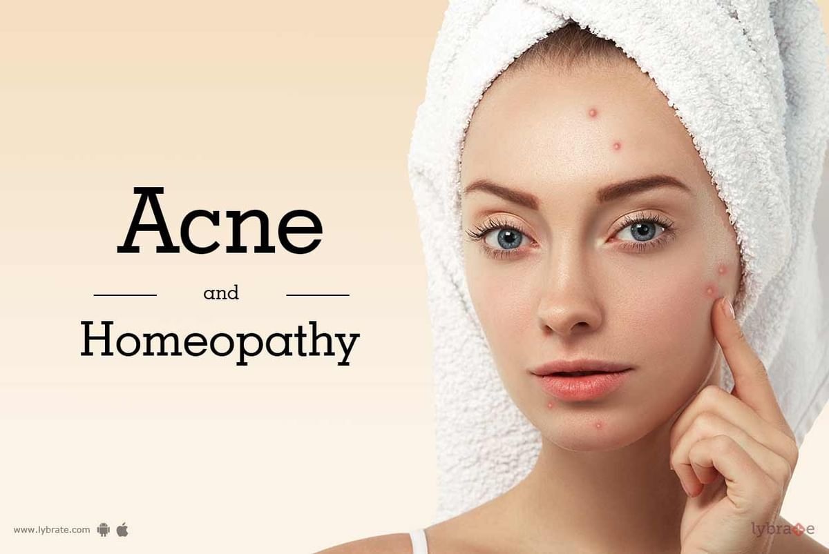 Acne and Homeopathy - By Dr. Archana Agarwal | Lybrate