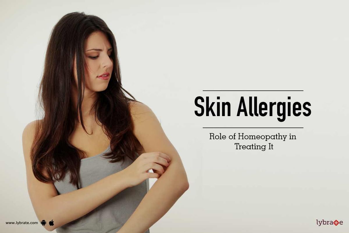 Skin Allergies - Role of Homeopathy in Treating It - By Dr. Rashid ...