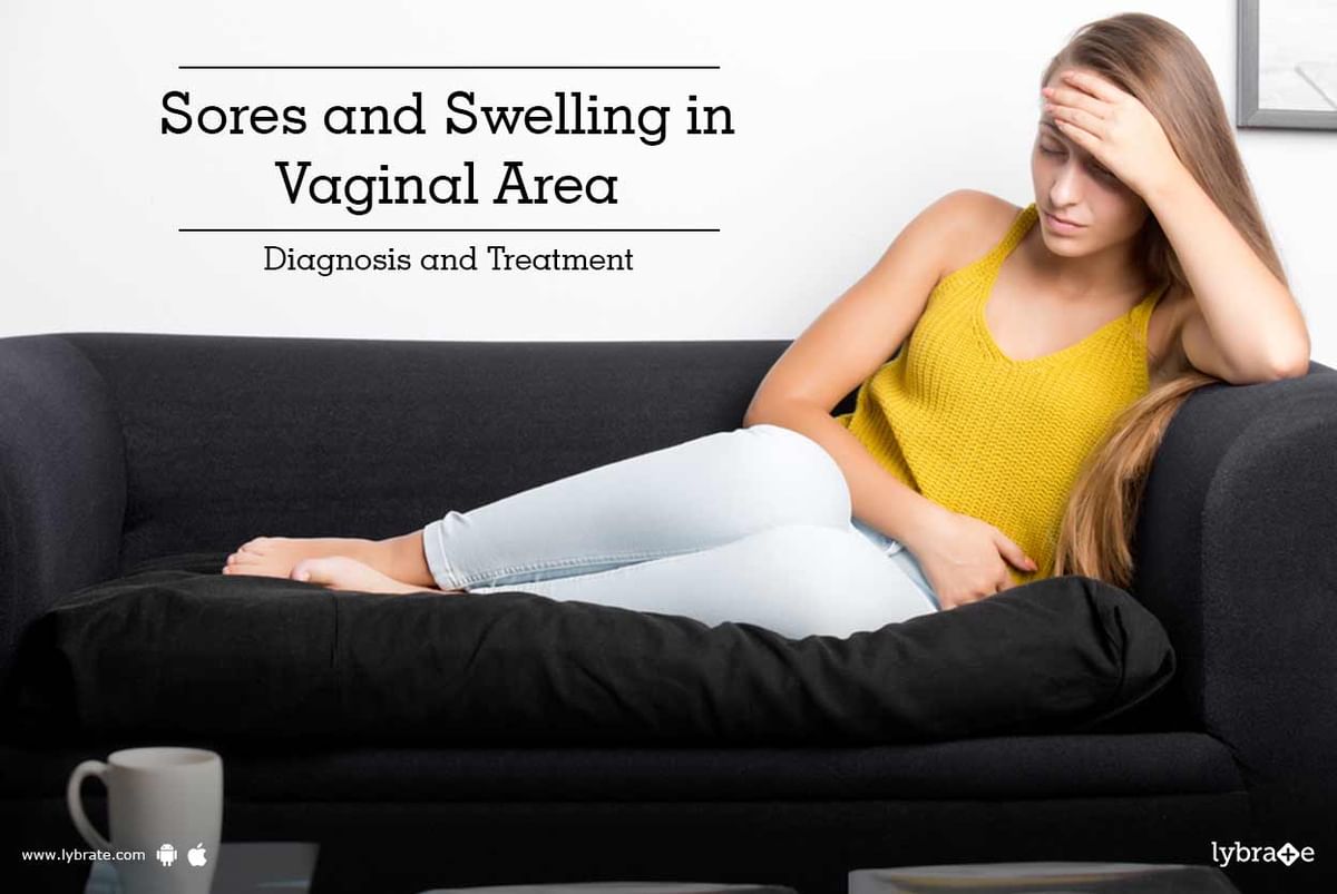 Sores and Swelling in Vaginal Area - Diagnosis and Treatment - By Dr. Mukti Sethi | Lybrate