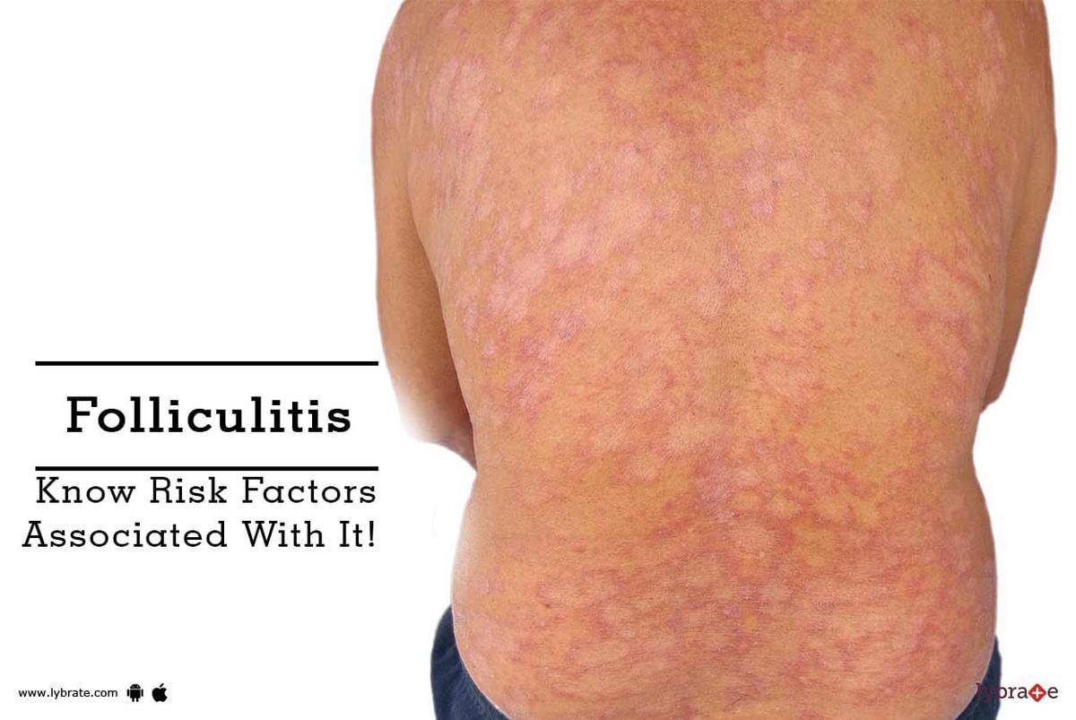 Quick Facts Folliculitis and Skin Abscesses  MSD Manual Consumer Version