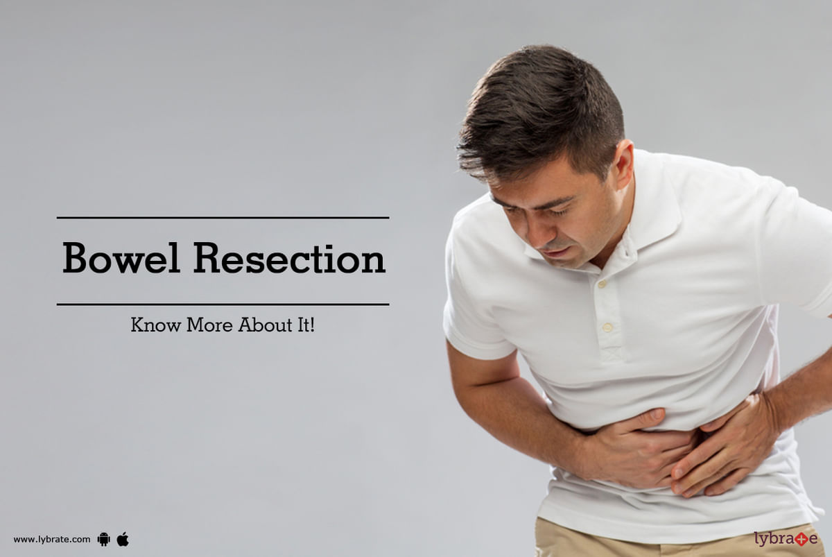 Bowel Resection - Know More About It! - By Dr. Hemendra Singh | Lybrate