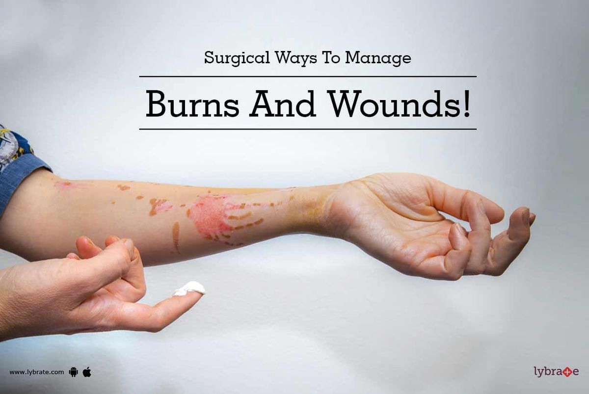 Surgical Ways To Manage Burns And Wounds! - By Dr. Ashutosh Shah | Lybrate